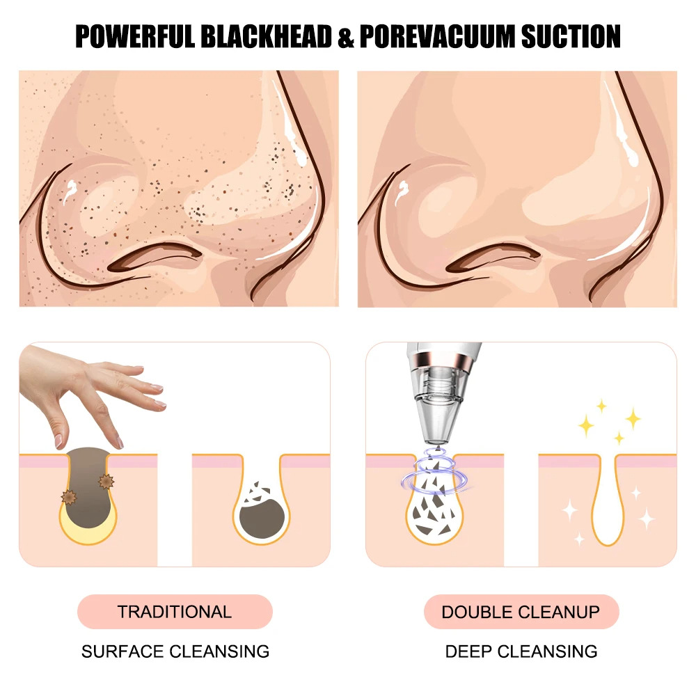 New electric blackhead removal and pore cleaning for blackheads - Image 2