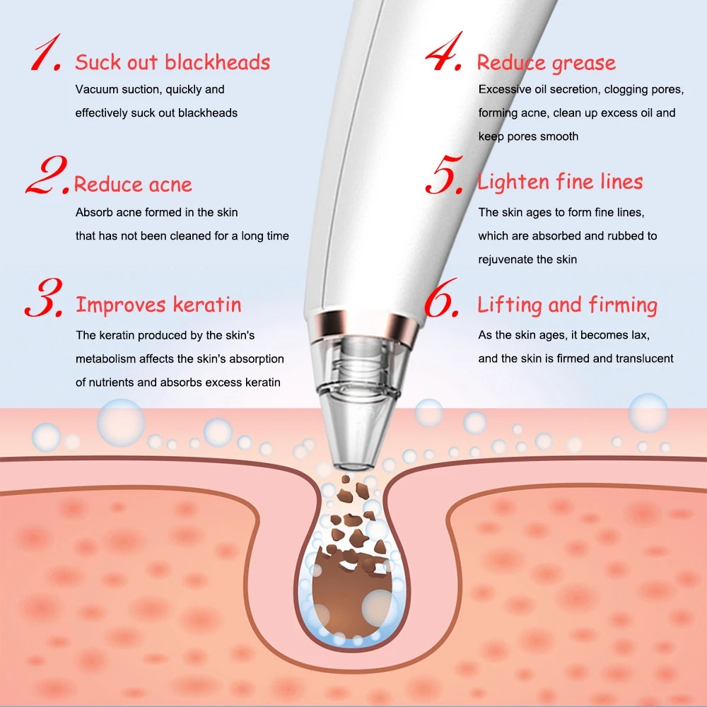 New electric blackhead removal and pore cleaning for blackheads - Image 3