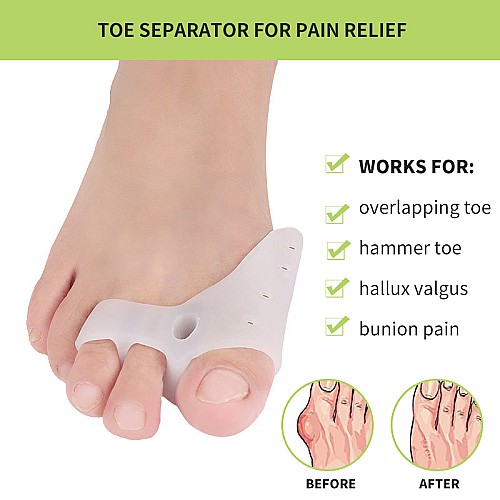 Magnet toe corrector