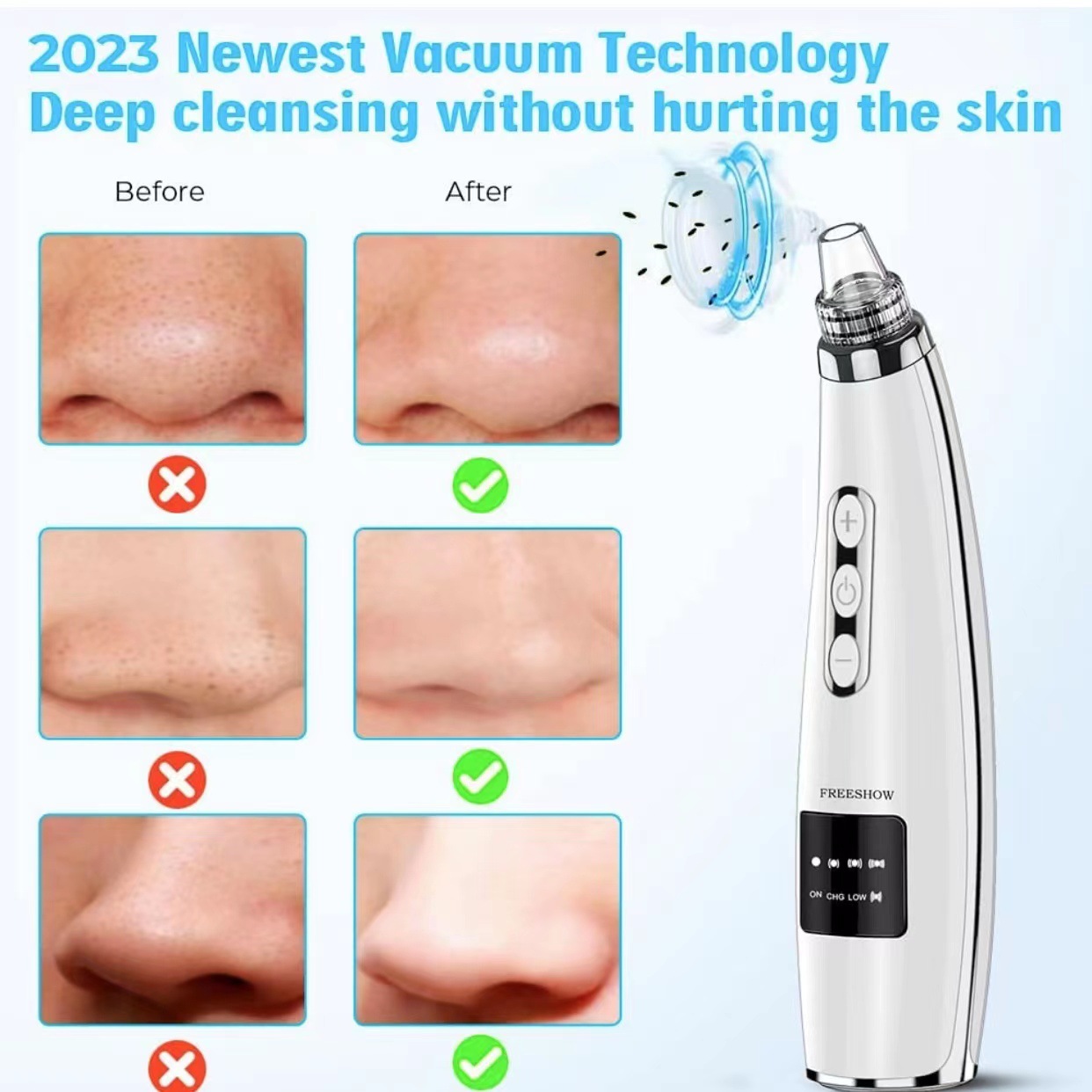 Portable Home Pore Cleaner Blackhead Device - Image 3