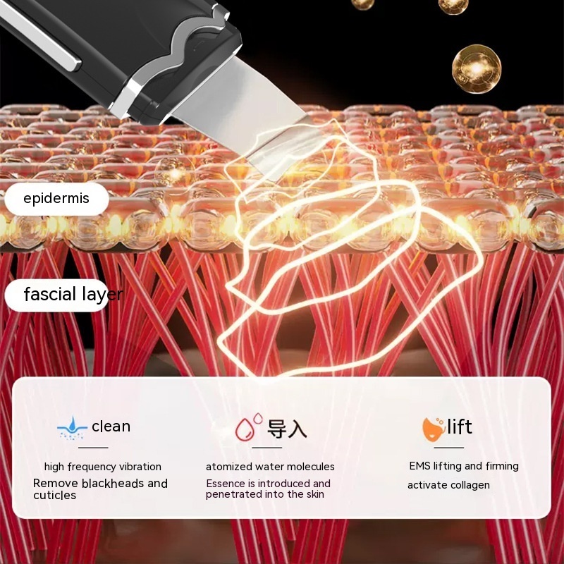 Ultrasonic Skin Cleaner Facial Pore Cleaning Pore Cleanser Lifting And Tightening Vibration Massage Beauty Import Instrument - Image 3