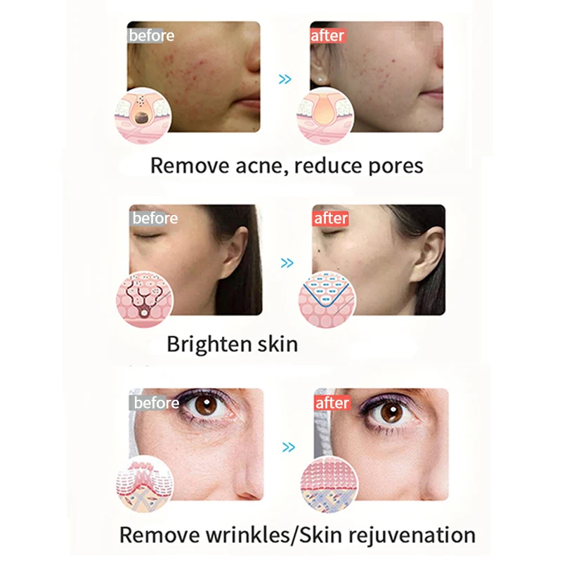 LED Face Light Therapy Photon Facial Mask 3 Color Anti Aging Wrinkle Skin Rejuvenation Skin Care Tool Home Beauty Instrument Spa - Image 4