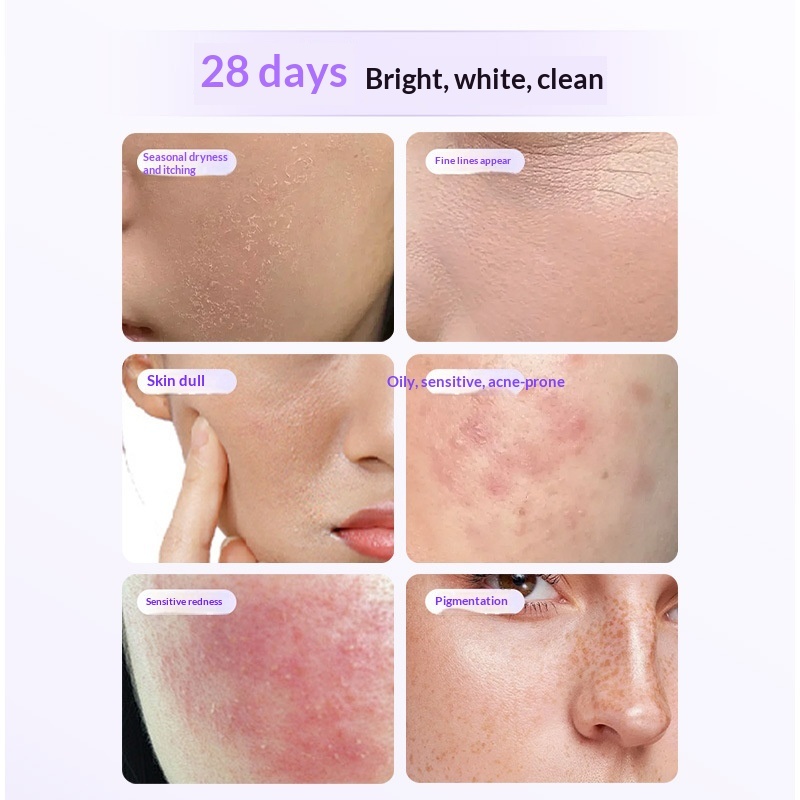 Silicone LED Red Light Photon Skin Rejuvenation Phototherapy Facial Beauty Device - Image 4