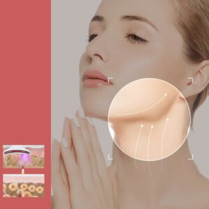 Skin Rejuvenation Face Lifting And Tightening RF Massage Instrument