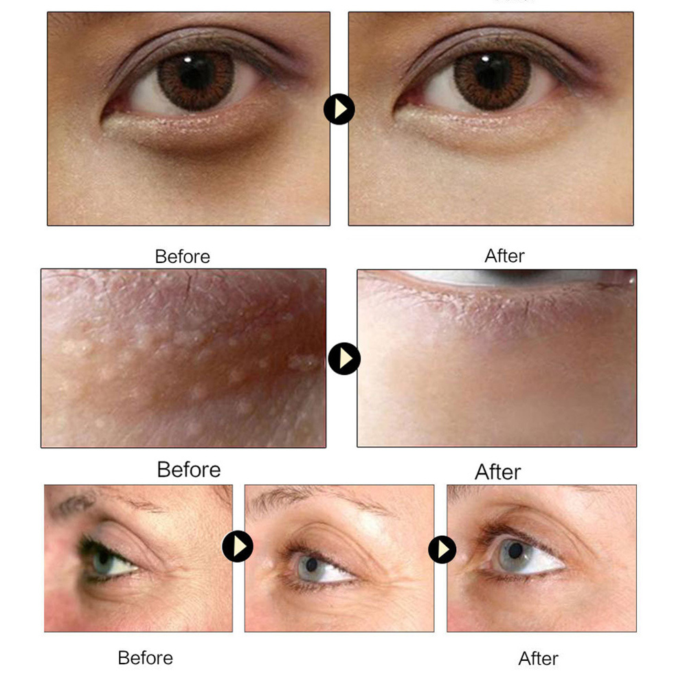 Gold Collagen Eye Mask - Image 3